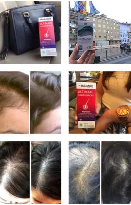 รีวิวผู้ใช้จริงยาปลูกผม Hair Soul - H Balanze Serum -- Mobile resize 1